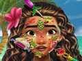 Laro Doktor ng Balat Moana online