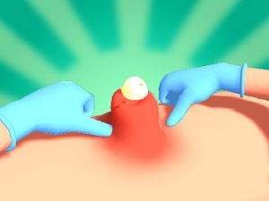 Laro Pimple pisilin online