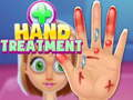 Laro Paggamot ng Kamay online