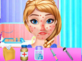 Laro Paggamot sa Allergy ng Tagsibol ni Anna online